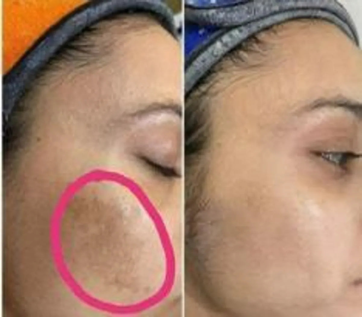 BYE BYE PIGMENTATION DUO