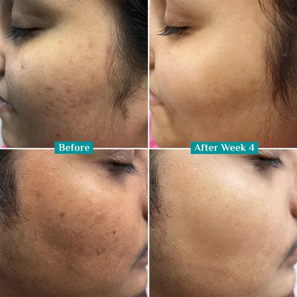 Anti-Pigmentation Face Wash (100ml*2)