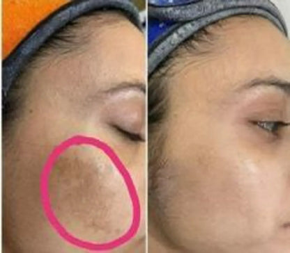 BYE BYE PIGMENTATION DUO