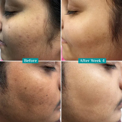 Anti-Pigmentation Face Wash (100ml*2)